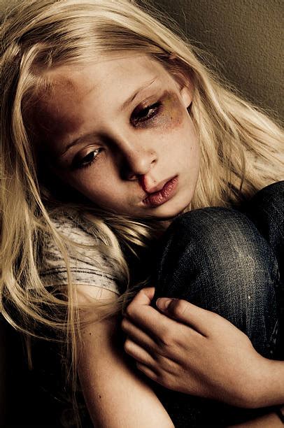 260+ Facial Expression Teenage Girls Child Abuse Abuse Stock Photos ...