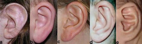 Normal Railroad Track Ears - Goimages Talk
