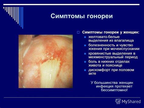 Диагностика сифилиса и гонореи - презентация онлайн