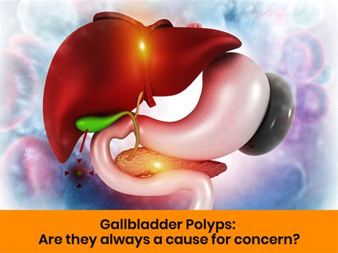 gallbladder polyps       concern