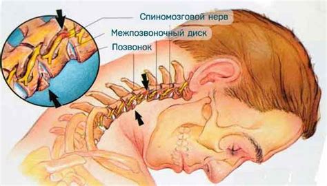 Как лечат остеохондроз в Хуньчуне