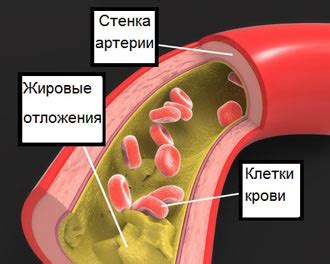 Триглицериды в крови: что это, норма у мужчин и женщин