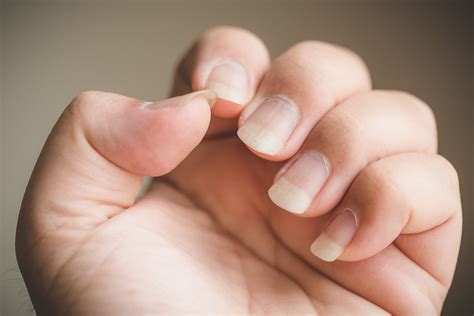 Nail Abnormalities - NEDA Skin Solutions | Dermatology