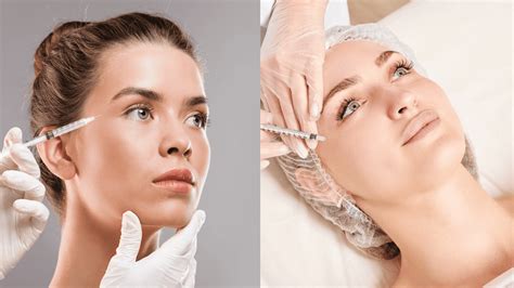 Botox vs. Dysport Injections: Which One is Right for You?