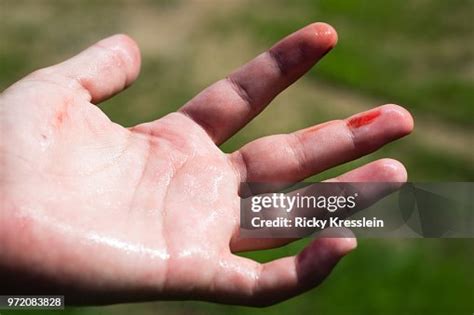 Bloody Finger High-Res Stock Photo - Getty Images