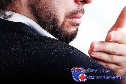 Народные методы лечения перхоти. Эффективны ли травы при проблемах с ...
