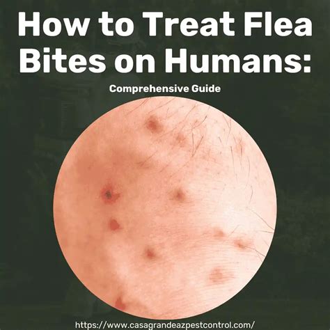 treat flea bites  humans comprehensive guide casa grande az