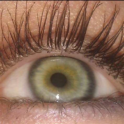 Central Heterochromia? : r/eyes