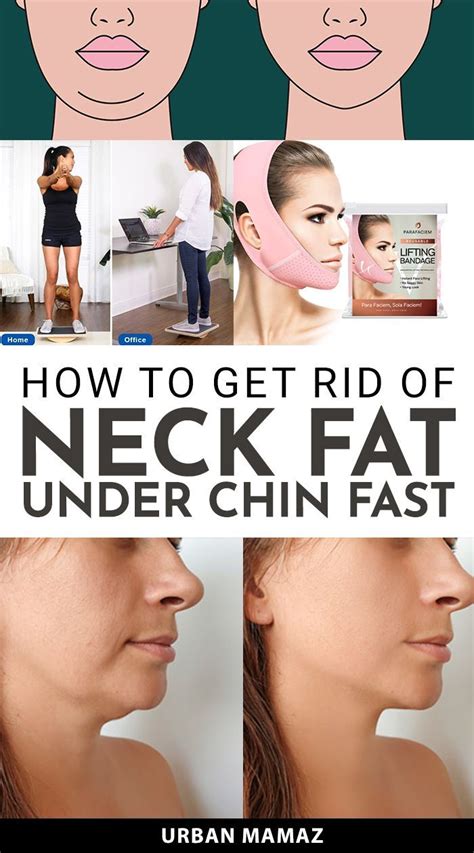 how to get rid of neck chin fat