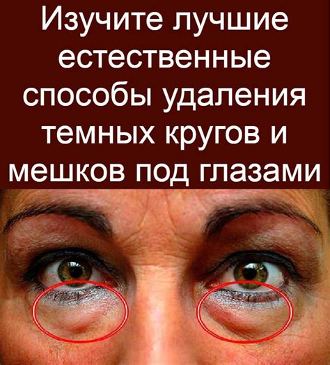 Советы | Мешки под глазами, Тёмные круги, Советы