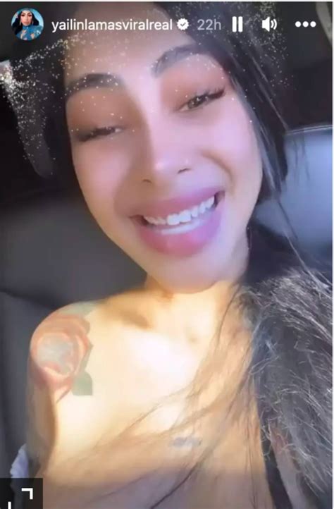 ¡Le falló el filtro! Así luce Yailin ´La más viral´ sin sus carillas