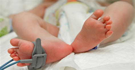 penyebab timbulnya tanda lahir  bayi okezone health