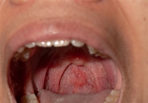Jaw Cysts and Jaw Tumors – DİŞMER Diş Merkezi