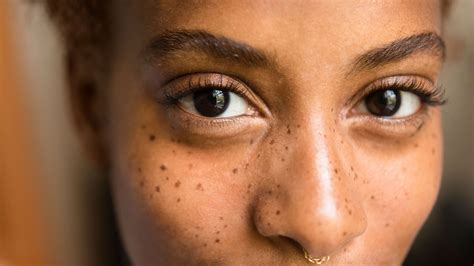 Cancerous Skin Moles What To Look For