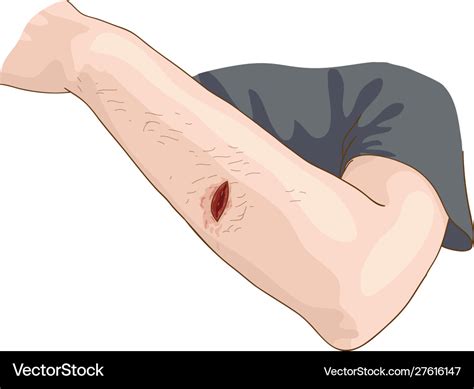 wound royalty  vector image vectorstock
