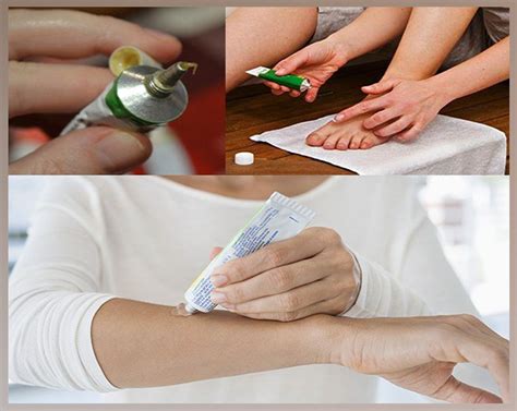 Тетрациклиновая мазь от экземы на ногах, руках: инструкция, отзывы