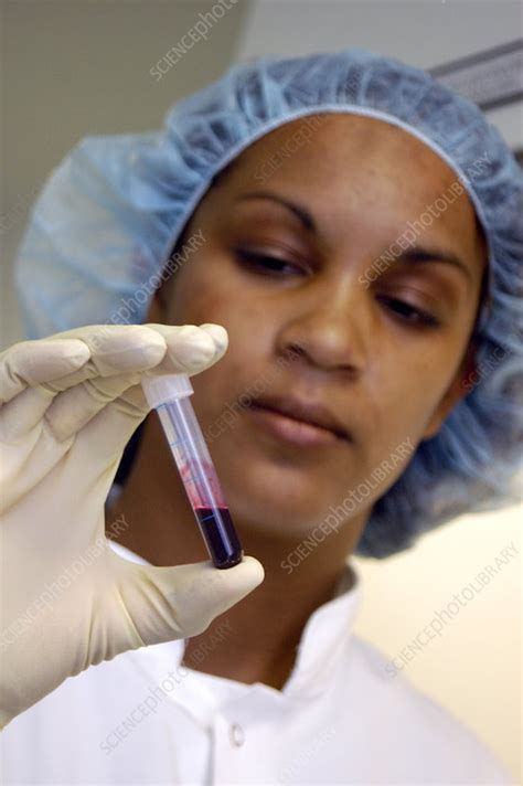 blood sample stock image  science photo library
