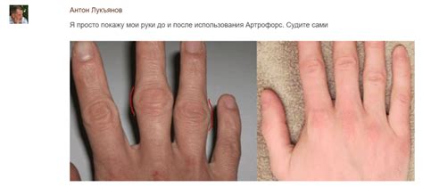 Артрофорс для суставов – цена, отзывы, инструкция