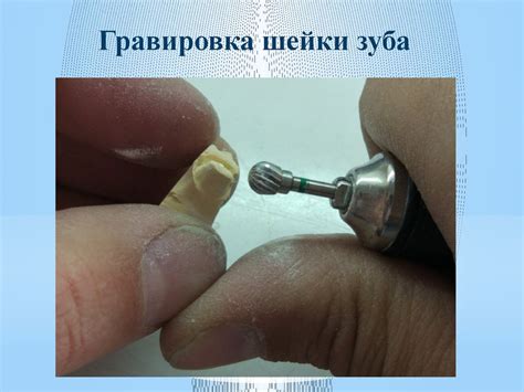 Технология изготовления цельнолитой коронки на моляр - презентация онлайн