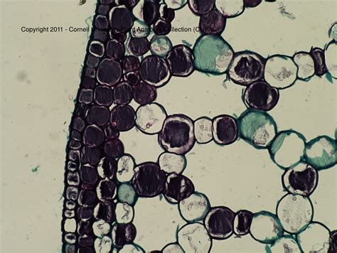 CUPAC ANATOMY SLIDE IMAGES