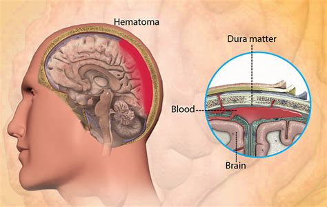 Health Condition : Symptoms, Causes, Treatment and More