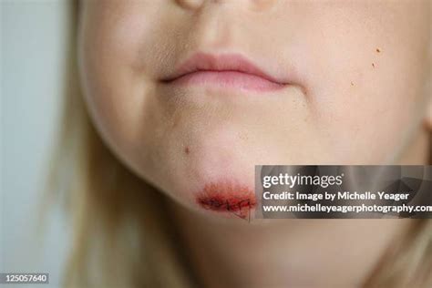 Head Injury In Children Photos and Premium High Res Pictures - Getty Images
