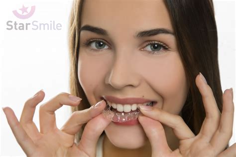 Исправление прикуса капами у взрослых и детей в Раменском - «New Smile»