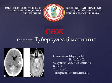 Туберкулезді менингит - презентация онлайн