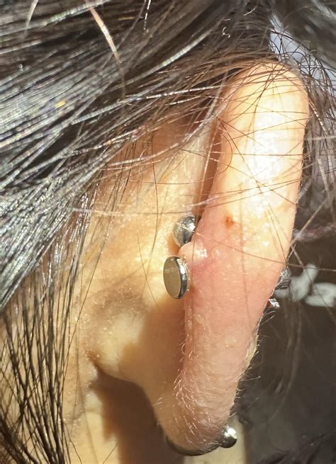 What is this bump and how do I treat it? : r/piercing
