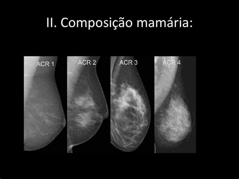 Bi rads - mamografia