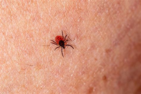 Common symptoms of tick bite you need to know