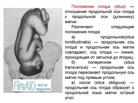 Диагностика беременности - презентация онлайн