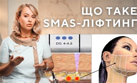 СМАС лифтинг Альтера в Киеве - Цены на Smas лифтинг в ANACOSMA