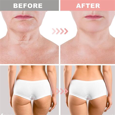 and Honey Firming Cream, Neck Firming Cream, Skin Tightening Cream