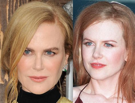 Nicole Kidman's Transformation: Fact Or Fiction? A Look At The Plastic ...