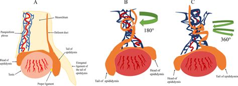 testicular torsion   horse   degrees  anatomy