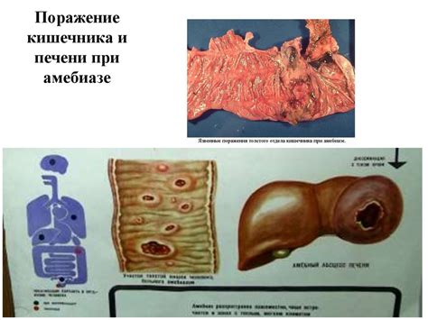 Медицинская протозоология. Царство Простейшие - презентация онлайн