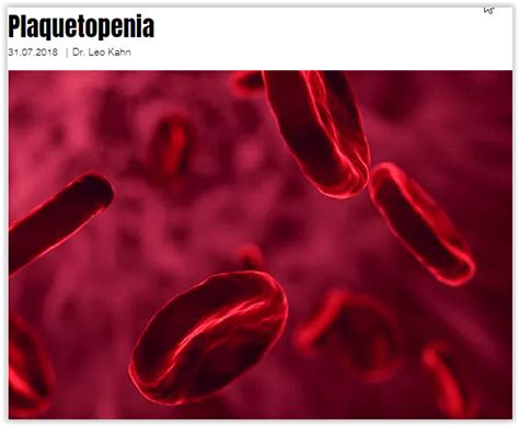 O Que É Plaquetopenia - Plaquetopenia. Também chamada trombocitopenia é uma… | by dr.leo kahn ...
