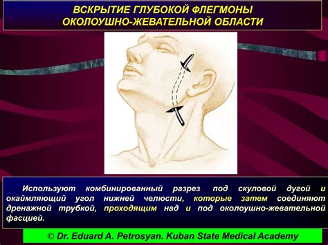 Операции на мозговом отделе головы - презентация онлайн
