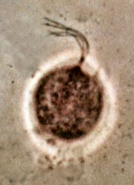 File:Trichomonas vaginalis phase contrast microscopy.jpg - Wikimedia ...