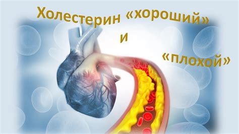 Холестерин холестерин хороший и плохой - YouTube