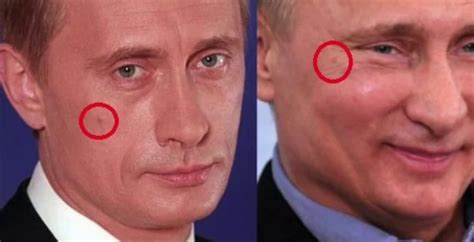 Путин И Ботокс Фото — Фото