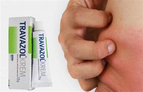 Travazol Krem Ne İşe Yarar ? Travazol Kullanımı ve Fiyatı - Bitkisel ...