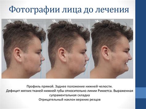 Диагностика. Фотографии лица до лечения - презентация онлайн