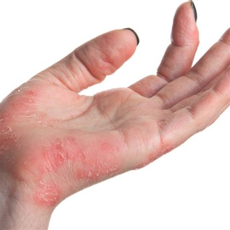Best skin specialist in Gurgaon | Estique Skin and Hair Clinic
