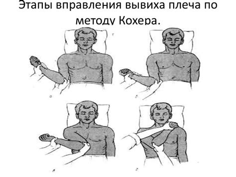 Методы вправления вывихов - презентация онлайн