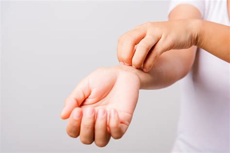 Asian Beautiful Woman Itching Her Useing Hand Scratch Itch Arm On White ...
