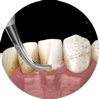Ирригатор Yamaguchi Oral Care купить в Москве