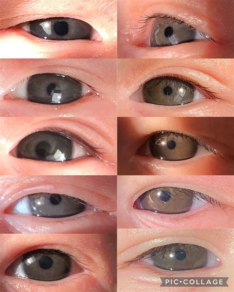 Baby Eye Color Change
