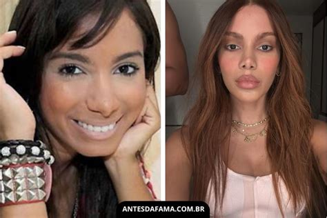Anitta Antes E Depois - Anitta: Antes e Depois da Fama – Antes da Fama